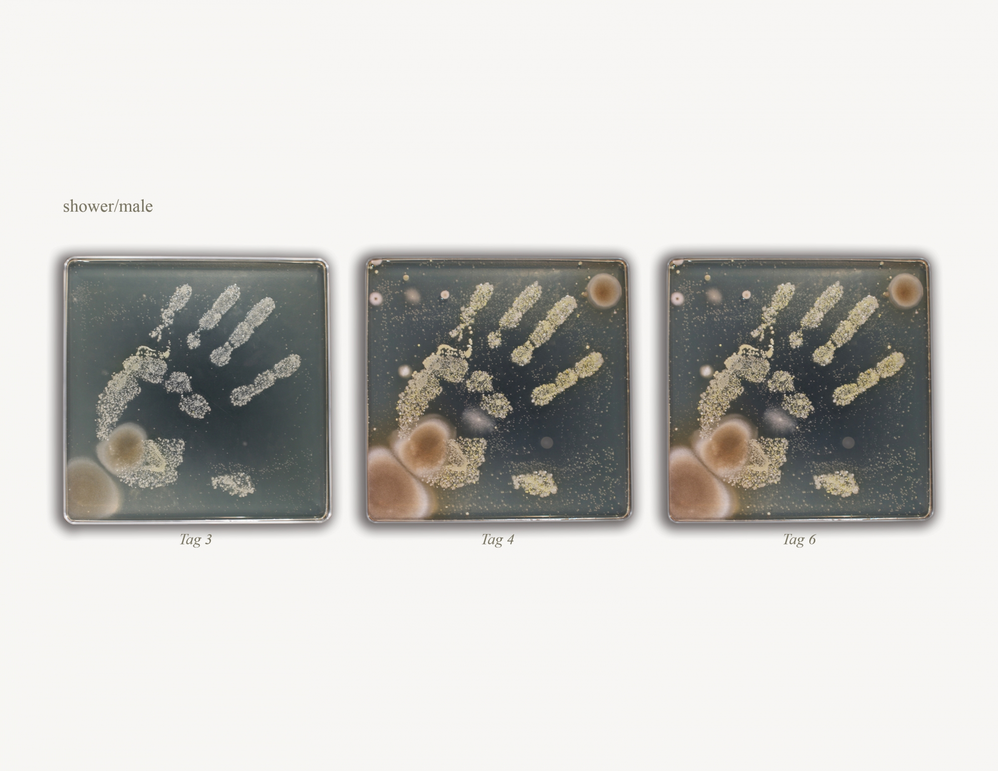 Staph Bacteria: The Unexpected Culprit Behind Milady Issues - b6ovfvj