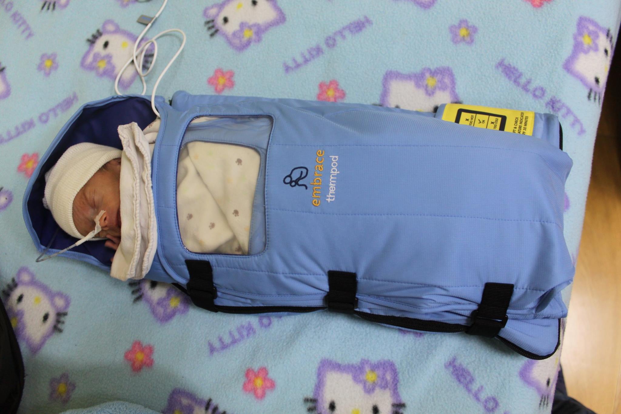 A lowtech solution to curb neonatal mortality Design Indaba