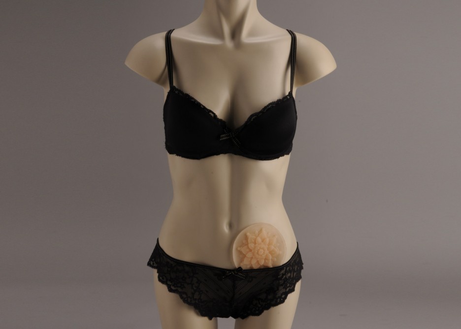 Colostomy Bag by Stephanie Monty