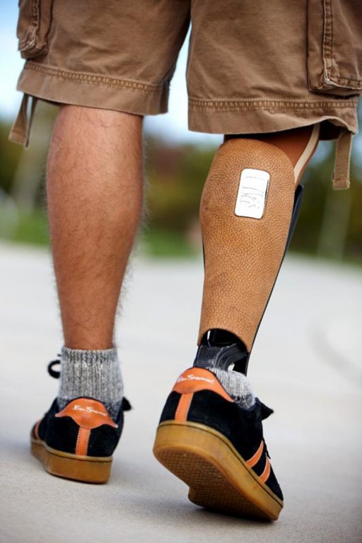 Mix'n'match prostheses | Design Indaba
