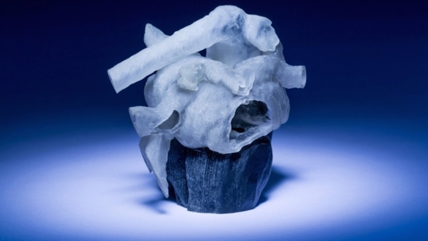 Researchers create a printable blueprint using the patient's MRI scans. 