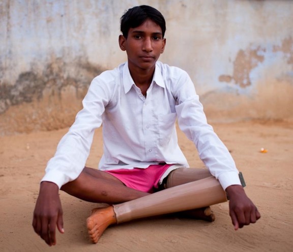 D-Rev, a company focusing on providing quality healthcare to low-income populations, is launching the ReMotion Knee. Image: Vishamber, who was fit with a Jaipur Knee