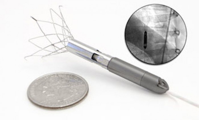 The device is thinner than a Number 2 pencil. The device is thinner than a Number 2 pencil.