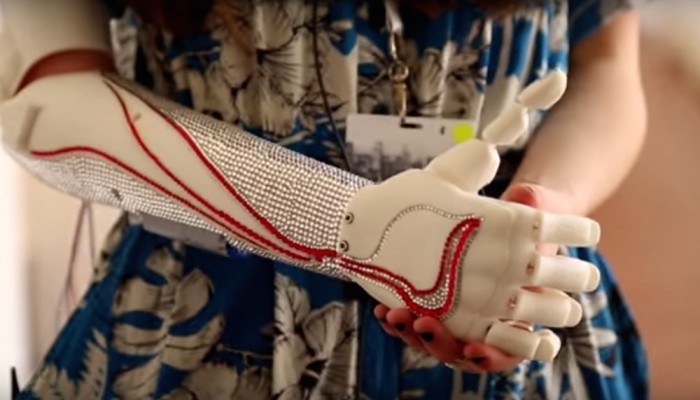 OpenBionics OpenBionics