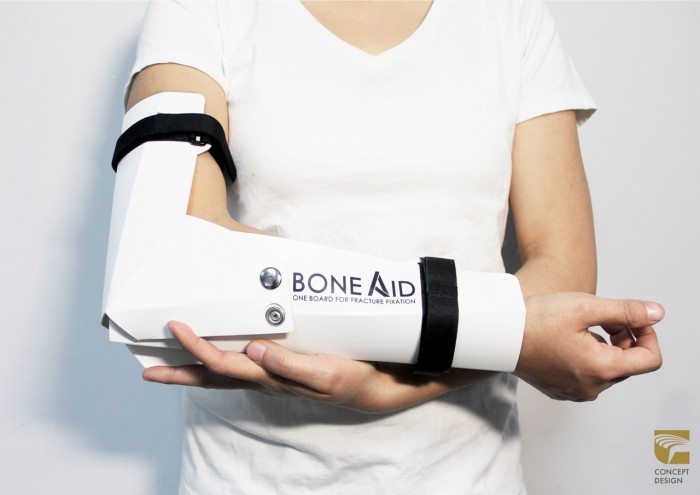 Taiwanese designers and students from Tunghai University, Yu-Chi Wang and Yu Man's bone fracture fixation board - BoneAid BoneAid is a multi-purpose bone rehabilitation board created for disaster relief emergencies.