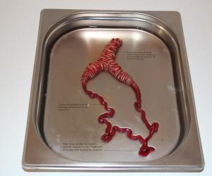 ‘Tremomucosa expulsum’ organ in its tray with descriptive annotations explaining the organ that is designed for cystic fibrosis sufferers.