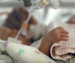 The artificial placenta could help severely premature babies