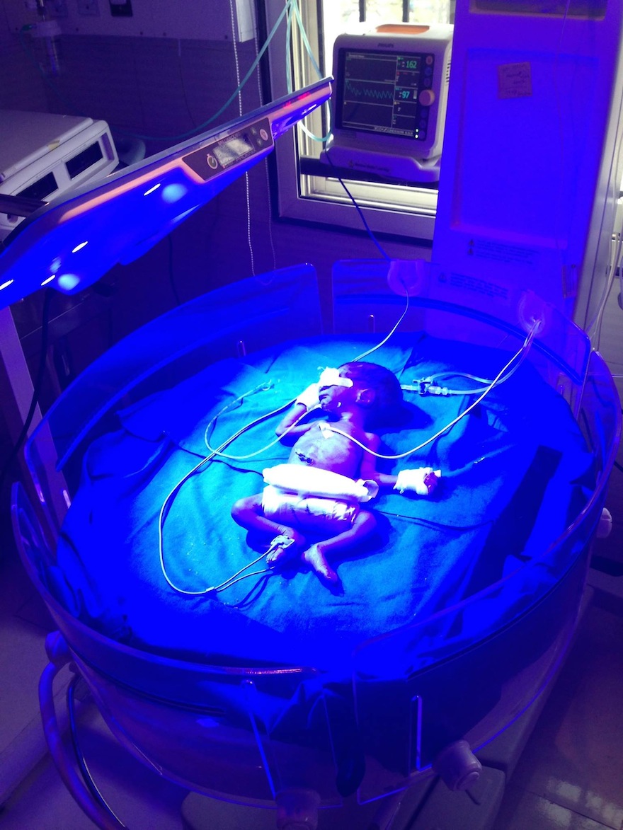 The Brilliance device treats babies with jaundice Design Indaba