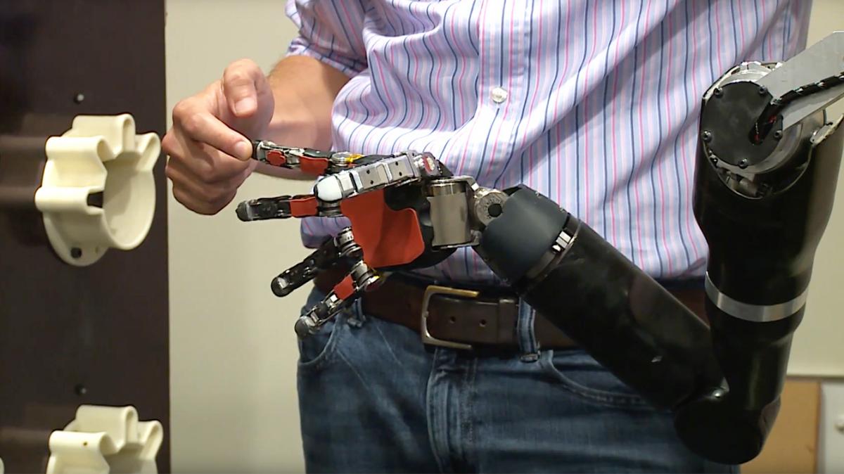 Mindcontrolled robotic arm allows man to feel again Design Indaba