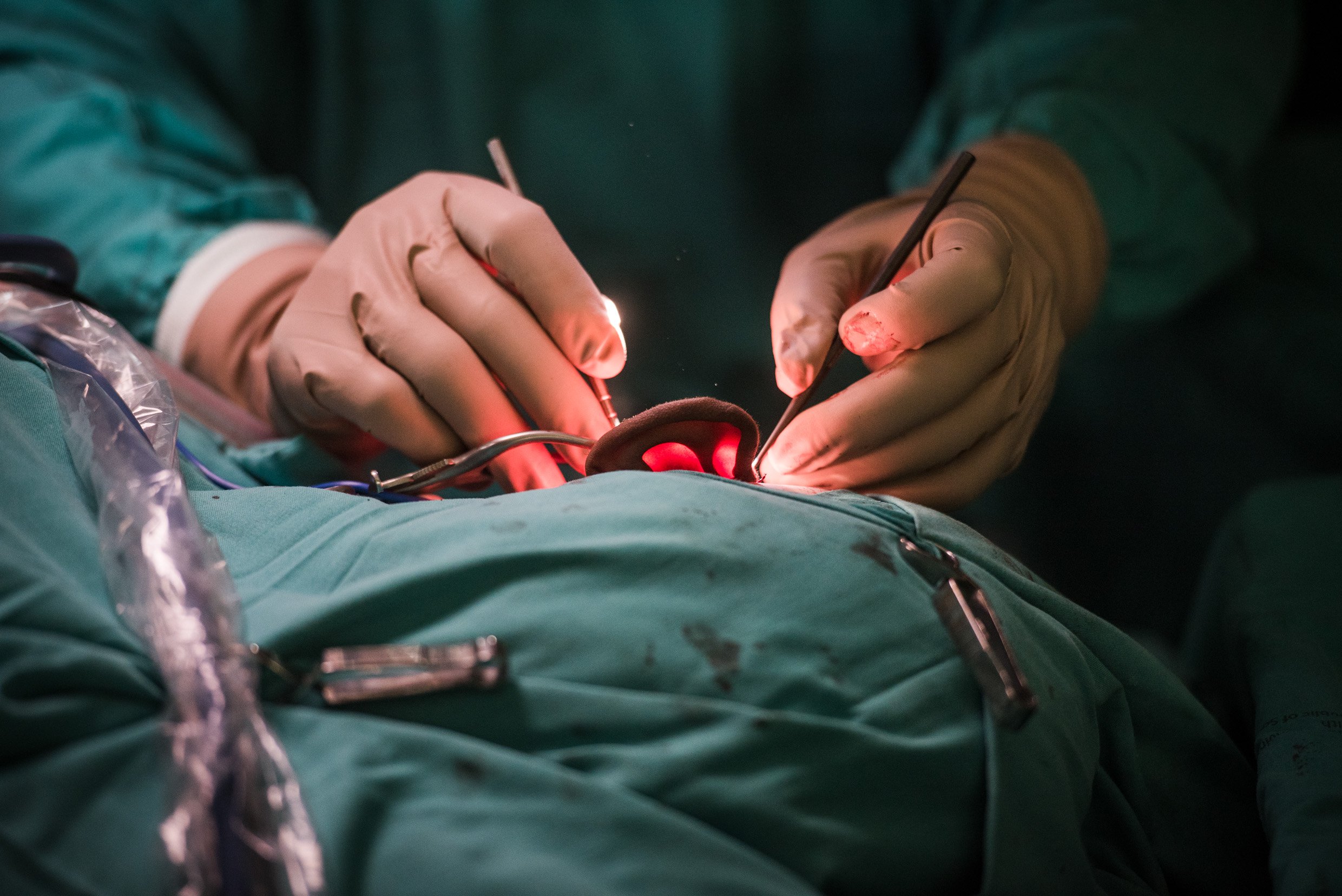 The world’s first 3D printed middle ear transplant happened in South