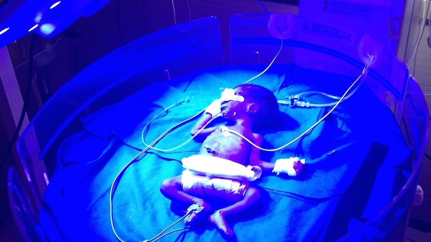 The Brilliance, designed by nonprofit D-Rev, is a phototherapy device designed to treat infants with jaundice in poor communities. Image: D-Rev