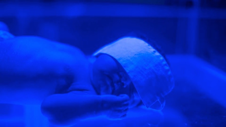 The Brilliance, designed by nonprofit D-Rev, is a phototherapy device designed to treat infants with jaundice in poor communities. Image: D-Rev