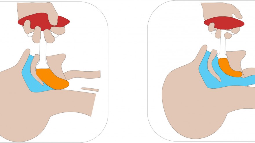 Green Product Award: The simple Su first aid tool can help prevent a person who has fainted or had a fit from choking on their tongue