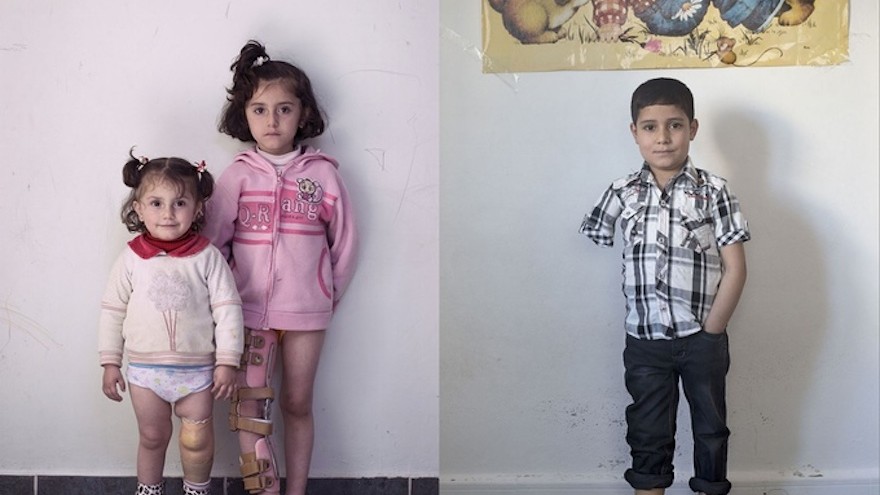 The exhibition will look at wounded Syrians 