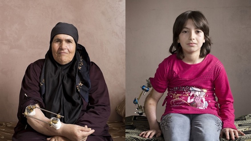 Images of wounded Syrians 