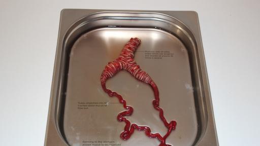 ‘Tremomucosa expulsum’ organ in its tray with descriptive annotations explaining the organ that is designed for cystic fibrosis sufferers.
