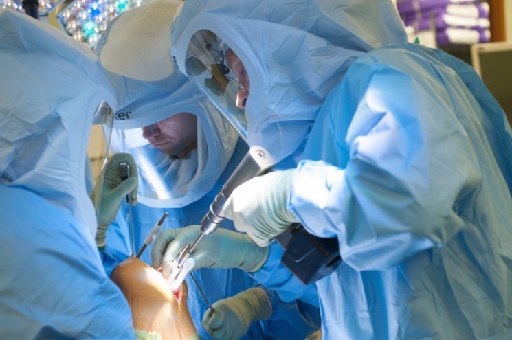 Surgeons using Embody's 3D printed guides to operate on a patient's knee.
