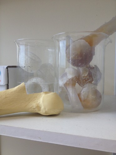 3D printed hip joints.