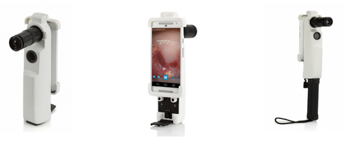 Israel-based MobileODT is leveraging the power of mobile phones and : to improve cervical cancer screening among women in high-risk, low-income areas. Image: http://finder.startupnationcentral.org/ Israel-based MobileODT is leveraging the power of mobile phones and selfies to improve cervical cancer screening among women in high-risk, low-income areas.