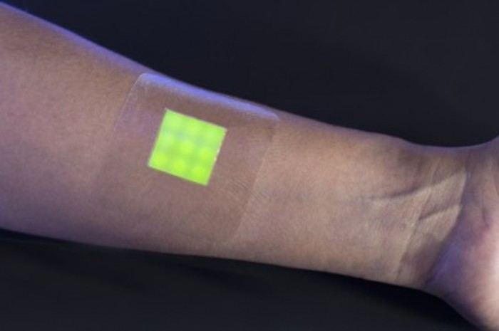 This smart burn dressing is designed to change colour when the patient’s burn wound is infected. This smart burn dressing is designed to change colour when the patient’s burn wound is infected.