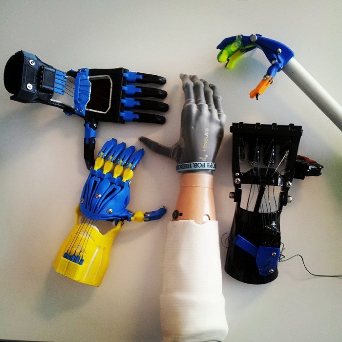 e-NABLE is a nonprofit global network of volunteers using their free time and respective skills to lend a helping hand to underserved children in need of assistive prosthetics