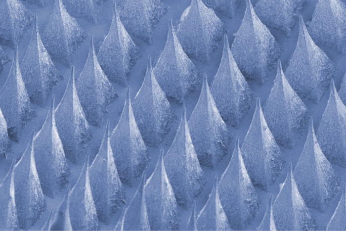 A scanning electron microscopic (SEM) image of the microneedle-array patch developed in the lab of Zhen Gu, PhD.