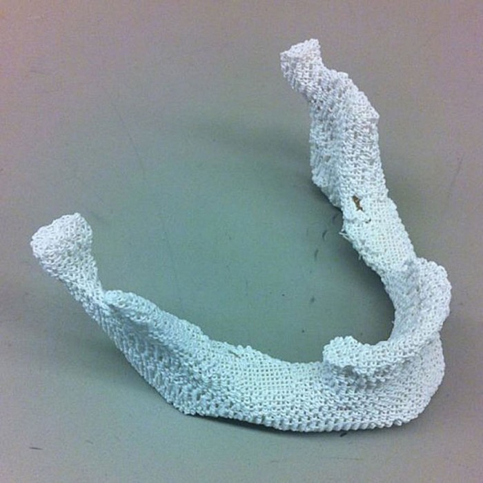 3D printed bone