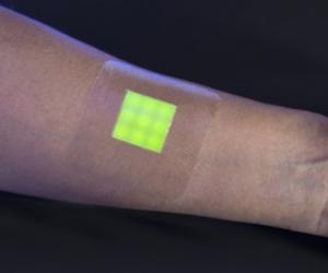 This smart burn dressing is designed to change colour when the patient’s burn wound is infected.